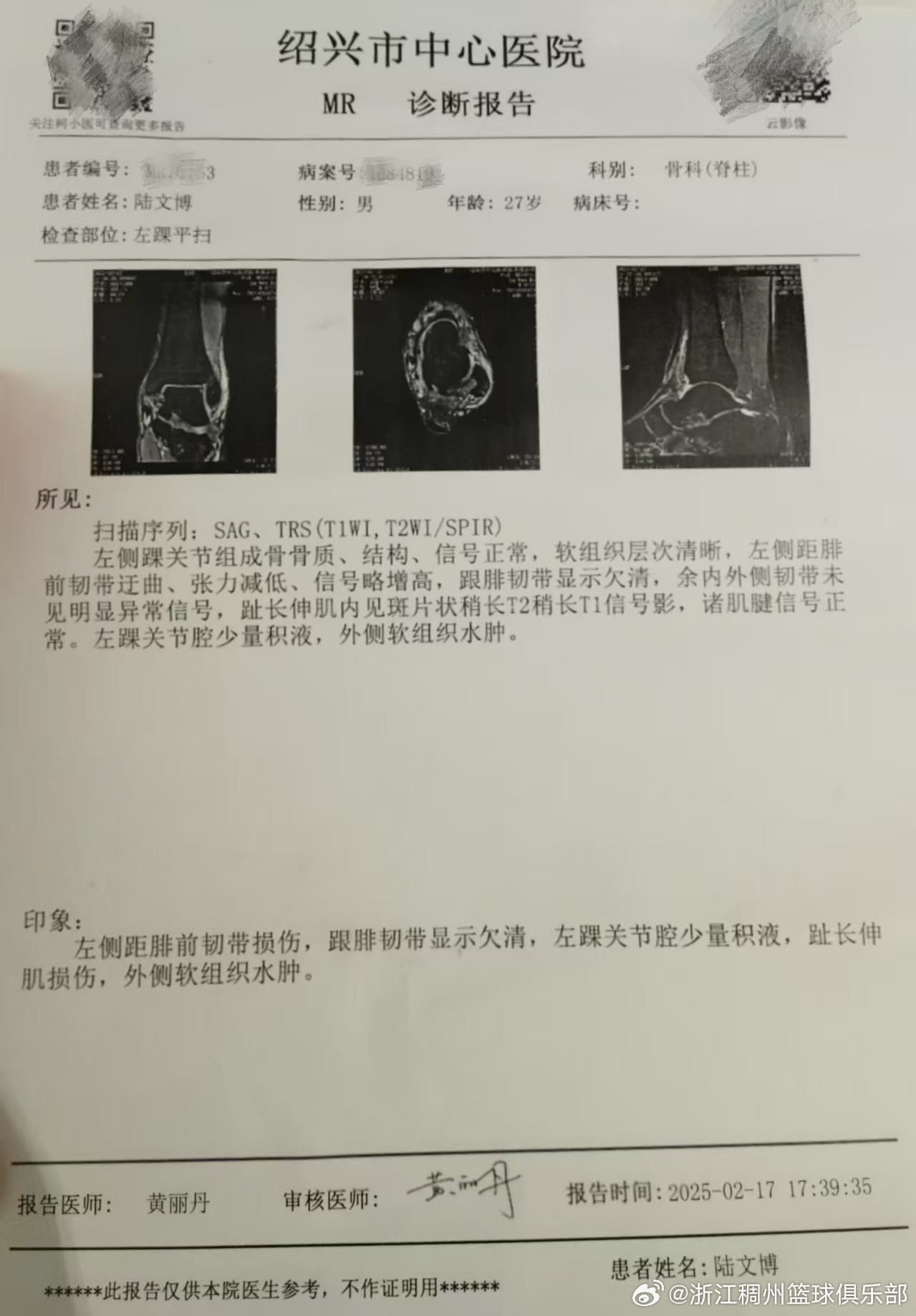 例如